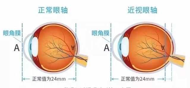 眼鏡可以帶上飛機嗎，五毫升的隱形眼鏡護理液可以隨身帶著(zhù)上飛機嗎？圖2
