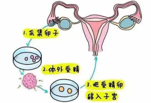 試管嬰兒怎么做的全過(guò)程
