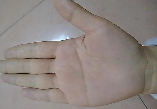 斷掌紋的女人