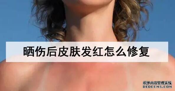 曬傷后皮膚發(fā)紅怎么修復
