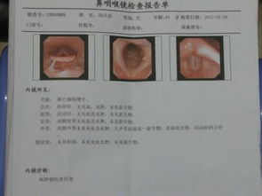 喉嚨檢查方法有哪些