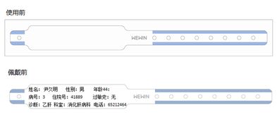 常用識別患者身份的方法有哪些