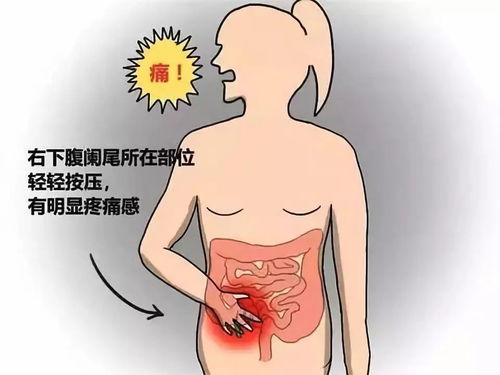 慢性盲腸炎會(huì )引起哪些不適療方法