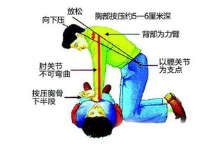 心臟復蘇有哪些方法