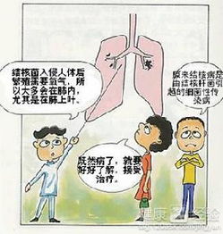 結核病中醫治療方法都有哪些呢
