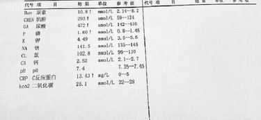 安陽(yáng)治療肌酐好的方法有哪些
