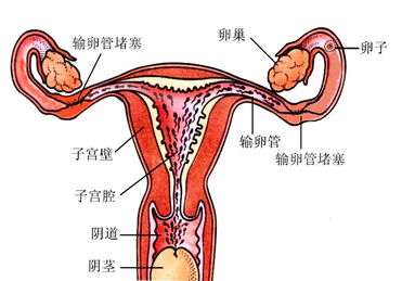 哪些方法治輸卵管不通好