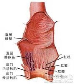 直腸造口注意事項