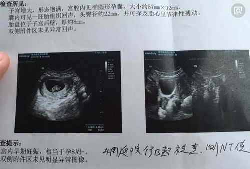 注意事項,懷孕