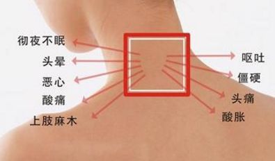 頸椎手術(shù)后注意事項,頸椎射頻消融術(shù)后注意事項,頸椎復位后的注意事項