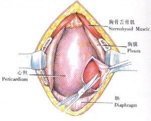 心包穿刺術(shù)后注意事項,心包穿刺術(shù)后護理注意事項,心包穿刺護理注意事項