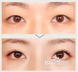 割雙眼皮注意事項辦法