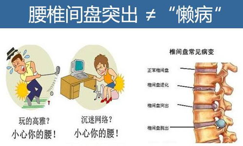 腰椎盤(pán)凸出手術(shù),腰椎盤(pán)凸出治療,腰椎盤(pán)微創(chuàng  )手術(shù)后注意事項