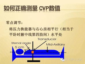 簡(jiǎn)述測量cvp的注意事項,測量CVP的注意事項,CVP注意事項