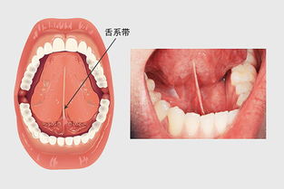 細帶,注意事項,手術(shù)