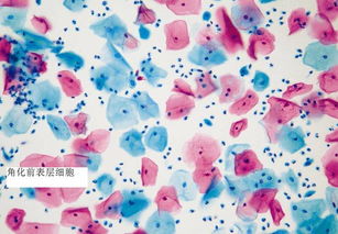 簡(jiǎn)單染色法注意事項
