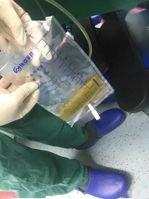 胸膜腔閉式引流的護理措施有什么,胸膜腔閉式引流的護理要點(diǎn),關(guān)于胸膜腔閉式引流的護理,錯誤的是()