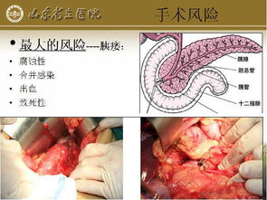 脾切除后吃藥注意事項