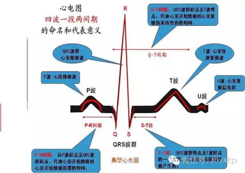 心電圖,測量,注意事項