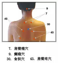 拔罐的禁忌和注意事項,拔罐注意事項和禁忌癥,拔罐的操作流程及注意事項