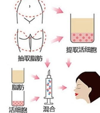 填充,注意事項