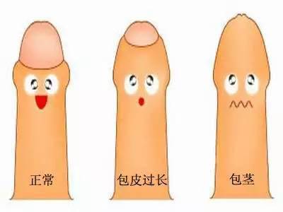 做完雙眼皮手術注意事項有哪些,做完人流后注意事項,做完光子嫩膚后注意事項