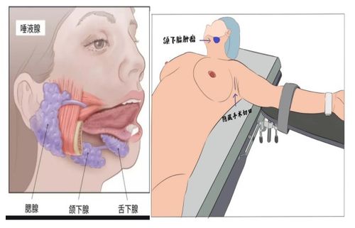 查甲狀腺掛什么科注意事項