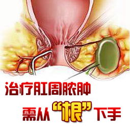 手術(shù)治療,注意事項