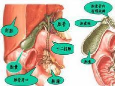 結石術(shù)后飲食注意事項,膽道鏡術(shù)后注意事項,膽道結石飲食注意事項