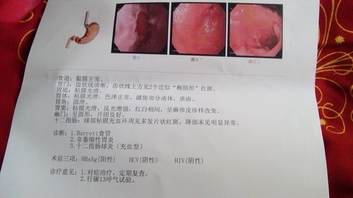 兒童胃鏡注意事項