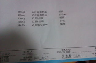 谷丙轉氨酶偏高注意事項