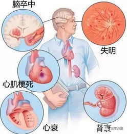 心臟病輸液注意事項,心臟病患者輸液注意事項,輸液五大注意事項