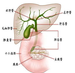 膽道,術(shù)后,結石,注意事項