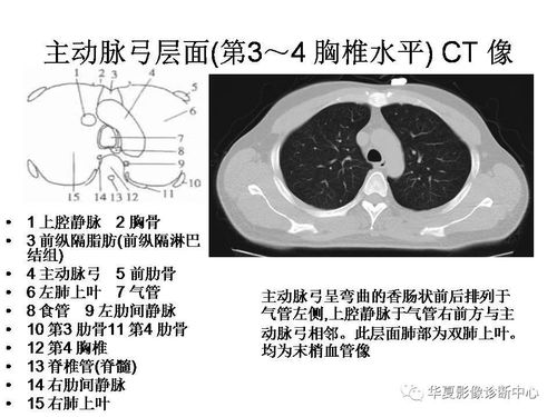 ct讀片基礎知識