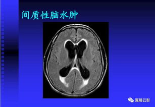 兒童頭顱mri基礎知識