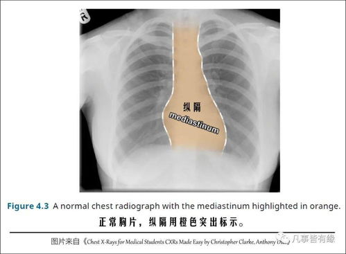 胸外泌尿基礎知識