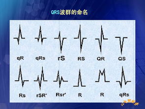 于小林心電圖基礎知識入門(mén)